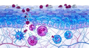 소아 아토피 피부염의 면역 반응과 피부 장벽 구조를 시각화한 3D 일러스트